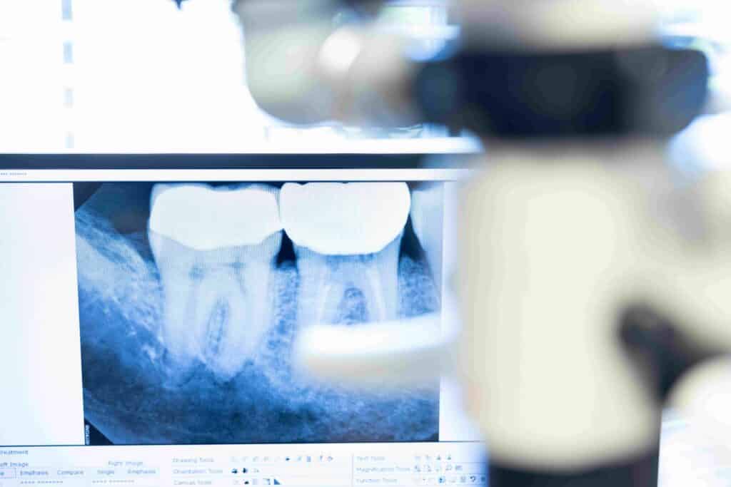 Cutting-Edge Endodontic Technology - Northwest Arkansas Endodontic Specialists